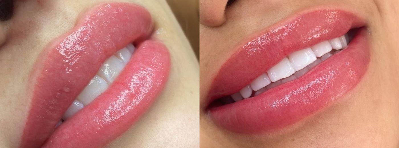 Lábios Desenhados e Definidos: Micropigmentação Labial