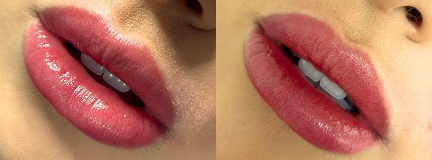 Micropigmentação de Lábios: Técnica Full Lips: Mais Volumosos, Desenhados e Definidos